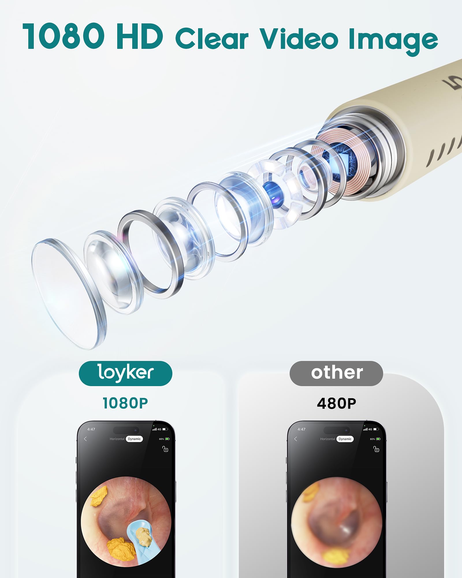 Loyker kit lights illuminate the ear canal with 6LEDs for better visibility
