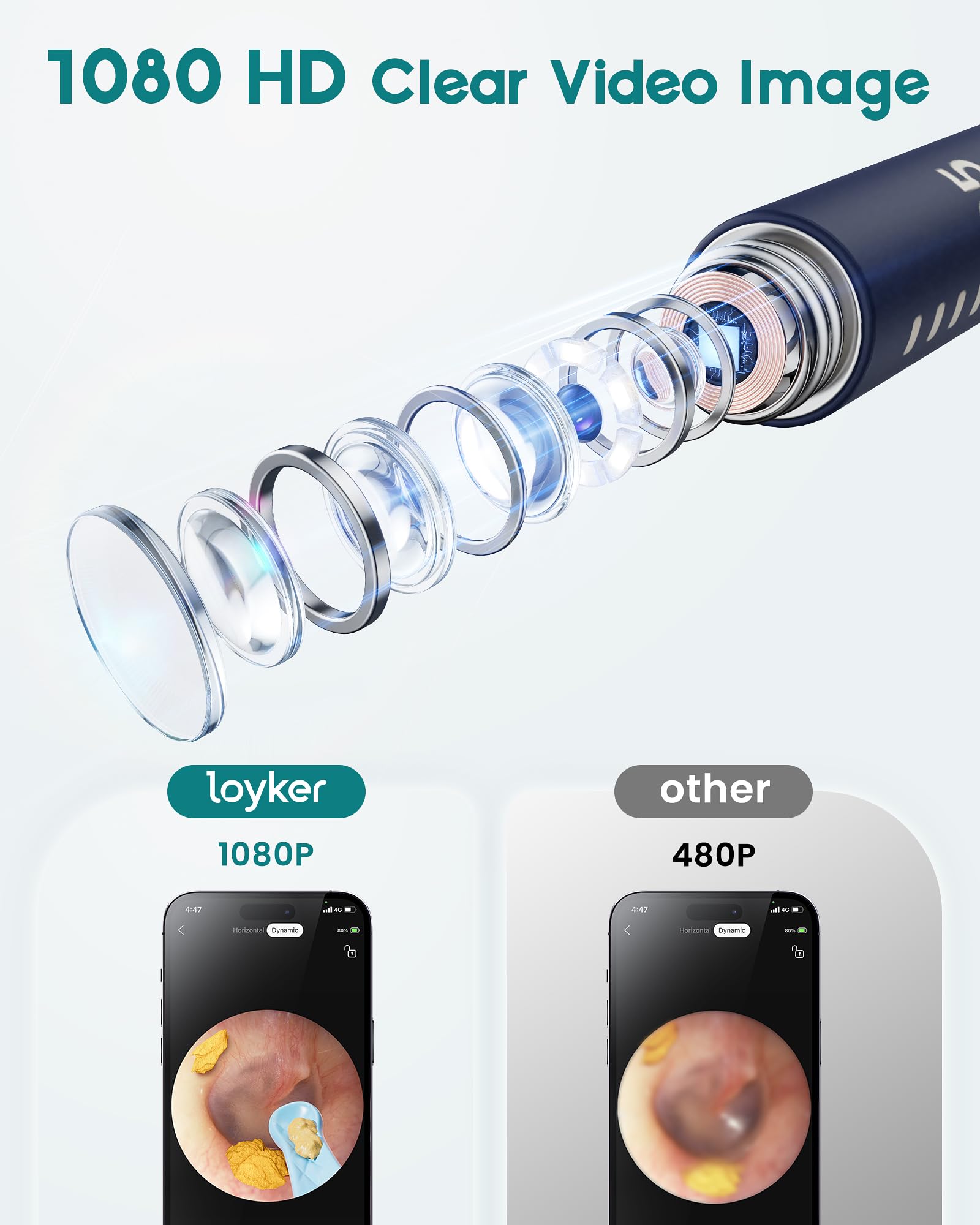 Loyker ear cleaner 6LED lights illuminate the ear canal for better visibility.