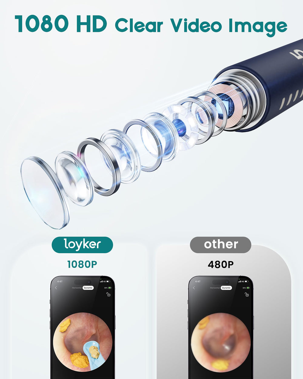 Loyker ear cleaner 6LED lights illuminate the ear canal for better visibility.