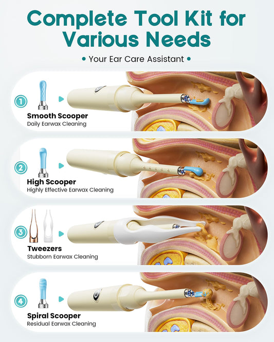 Loyker ear-cleaning-kit-tips set includes 12 pieces for versatile use