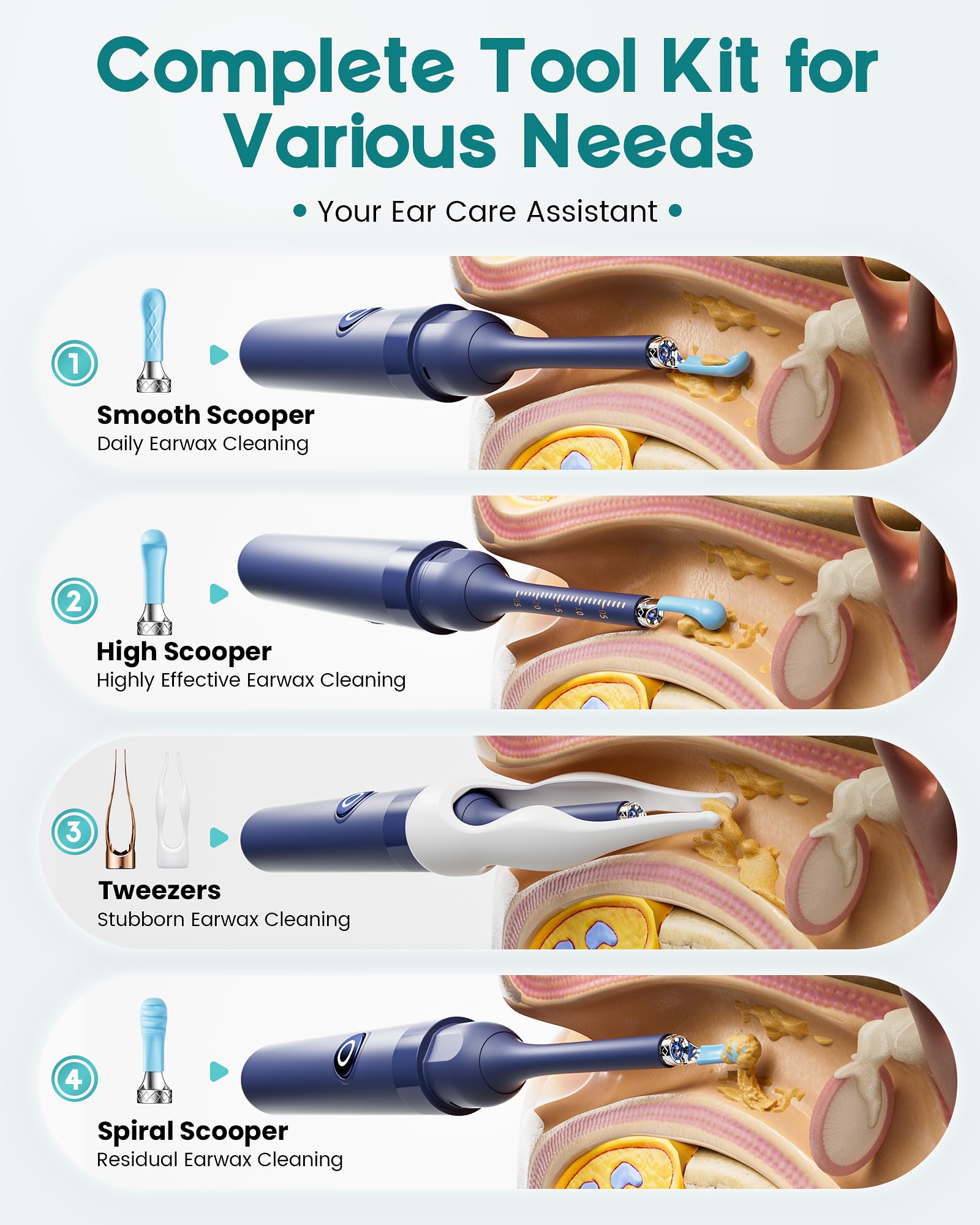 Loyker ear spoon tips kit with 12 tips for versatile ear care at home.