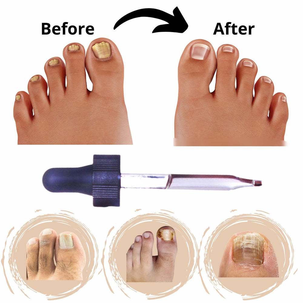 LucaED applying product on nail to support appearance.