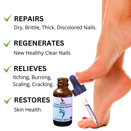 LucaED dropper applies solution directly to nails for targeted treatment.