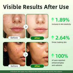 Lukaree Vitamin C Serum texture swirls on skin for smoothness
