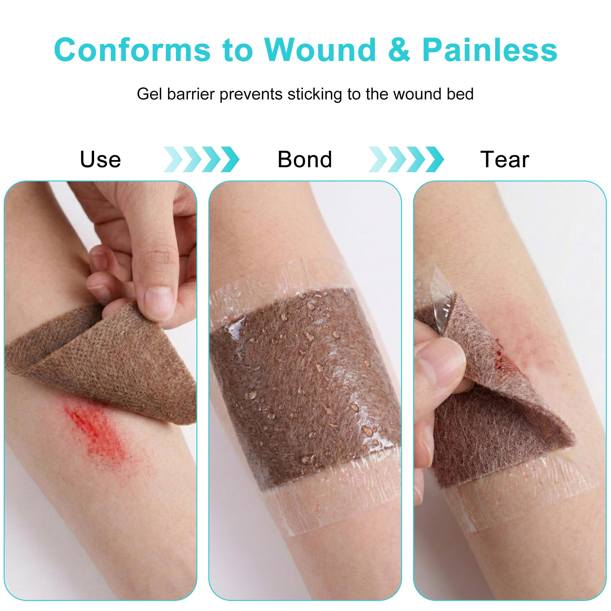 Lvonge conforms to irregular wounds for complete coverage with 4x4 dressings.