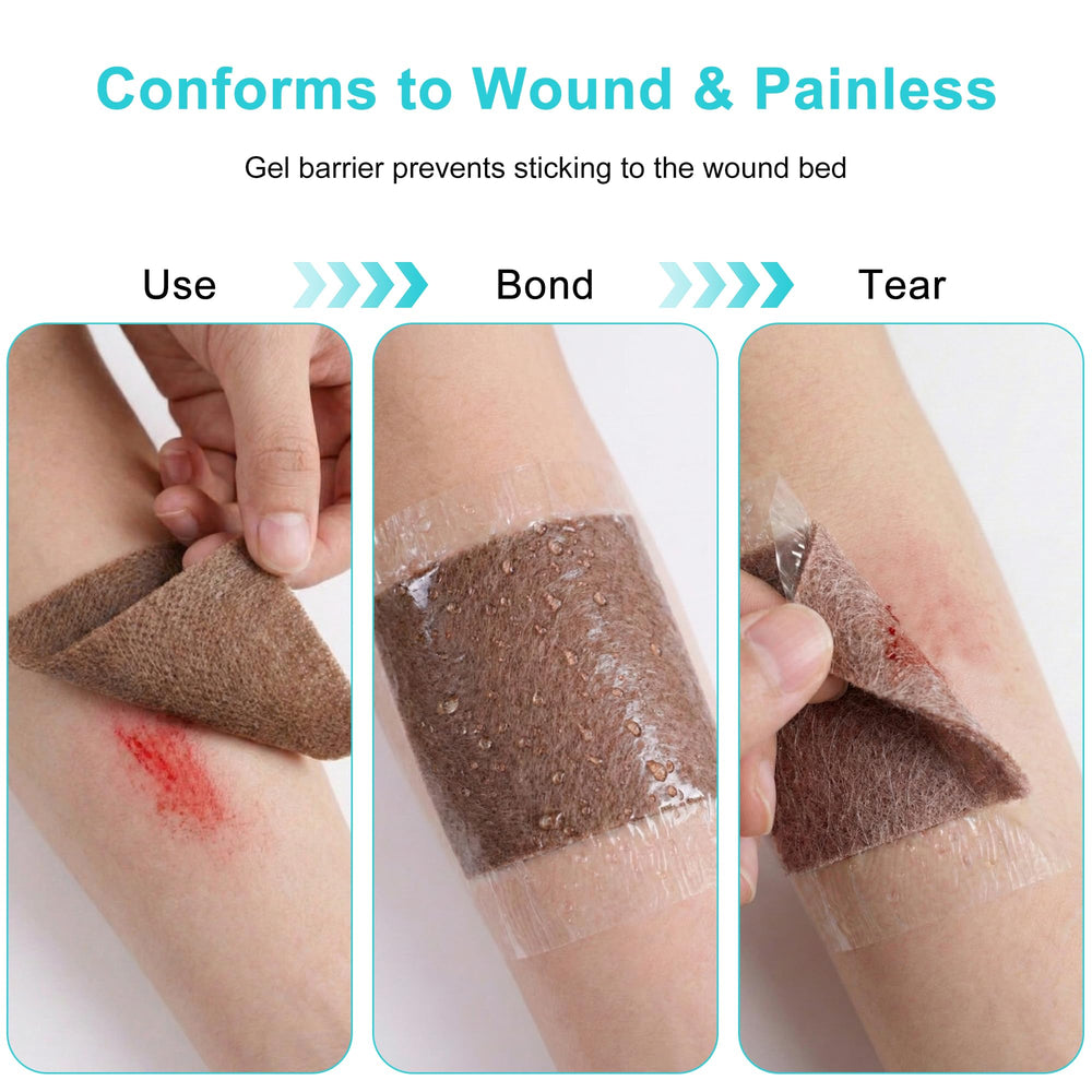Lvonge conforms to irregular wounds for complete coverage with 4x4 dressings.