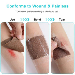 Lvonge conforms to irregular wounds for complete coverage with 4x4 dressings.