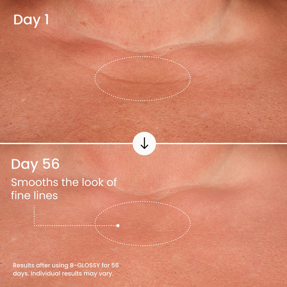 MAËLYS B-GLOSSY chest area showing texture refinement potential.