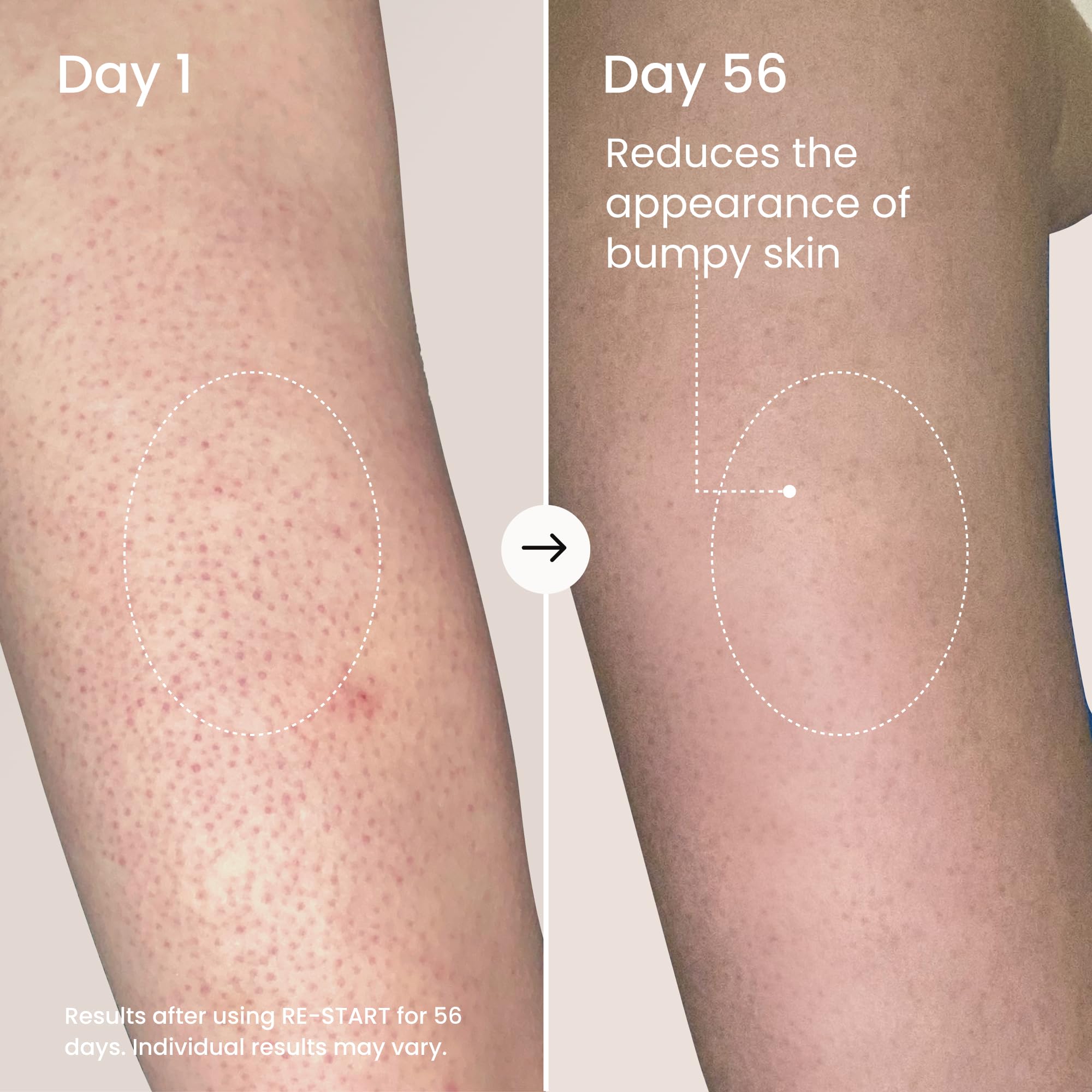MAËLYS RE-START exfoliation action image demonstrates 10% AHAs at work