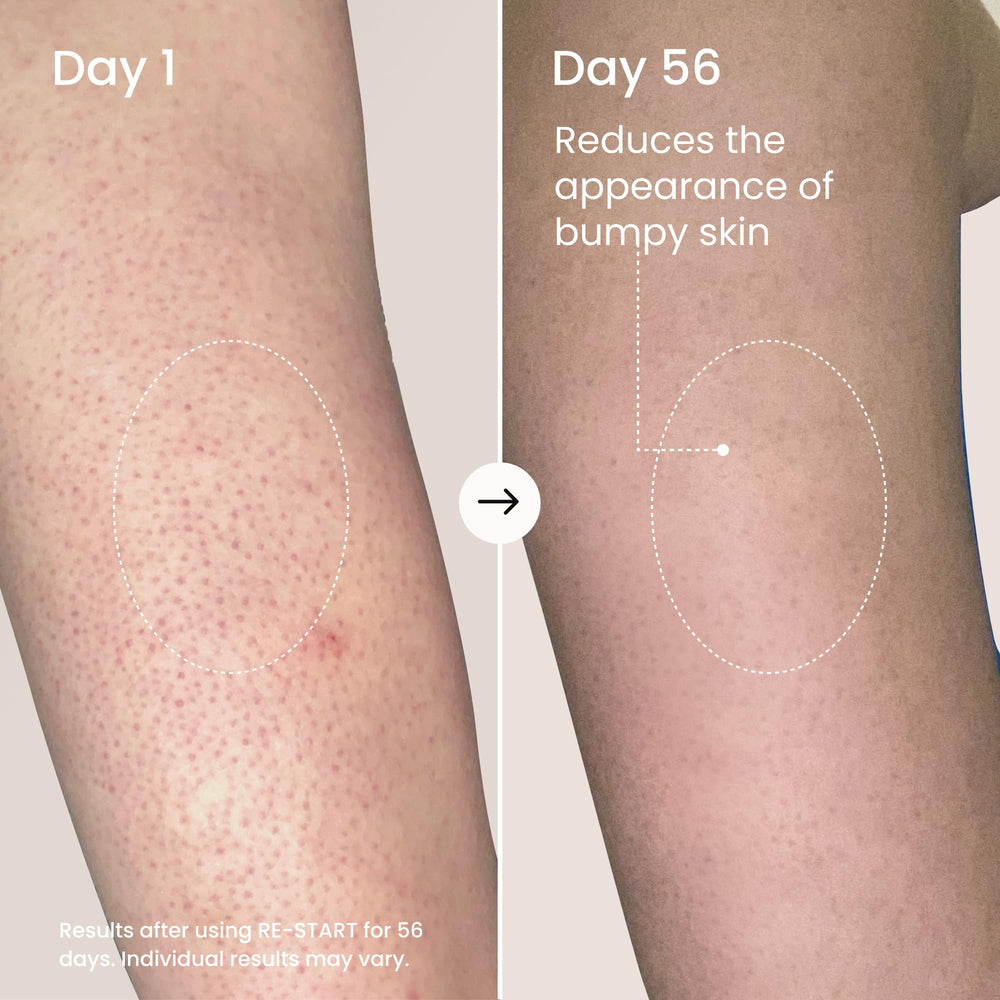 MAËLYS RE-START exfoliation action image demonstrates 10% AHAs at work