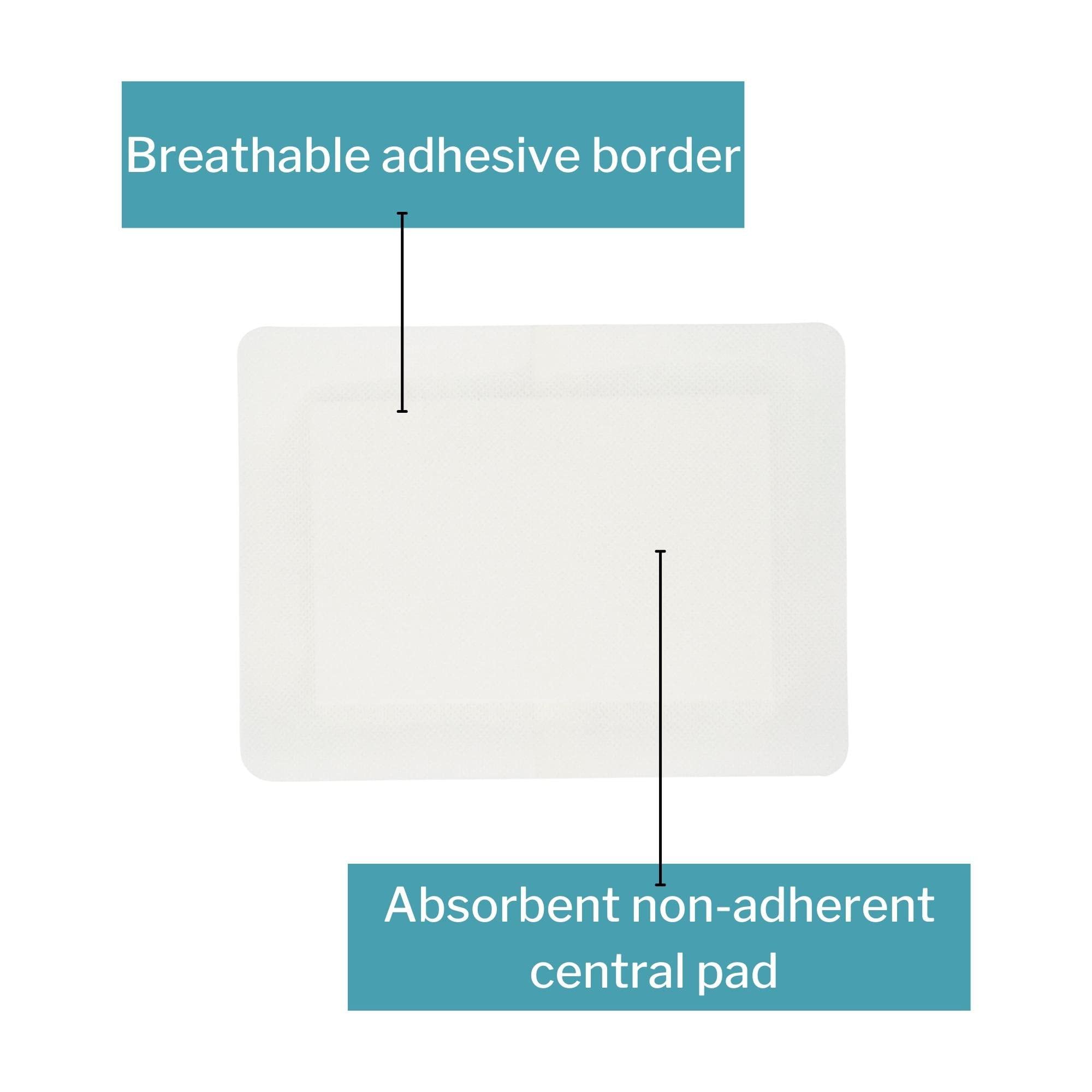McKesson Island Dressing adhesive 6x8 securely fits skin.