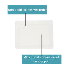 McKesson Island Dressing adhesive 6x8 securely fits skin.