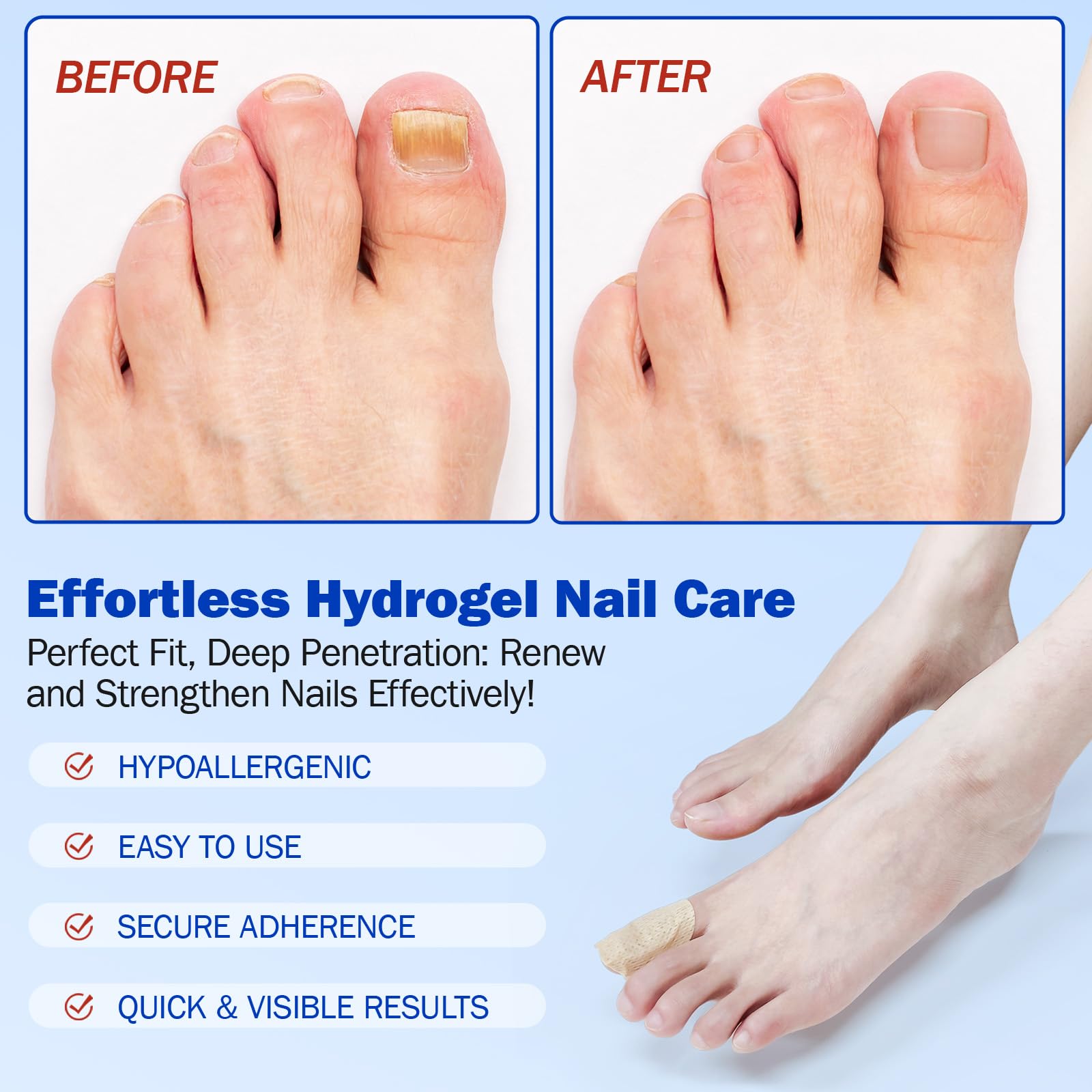 Mcukv Nail Repair Patches close-up, highlighting natural plant extracts