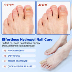 Mcukv Nail Repair Patches close-up, highlighting natural plant extracts