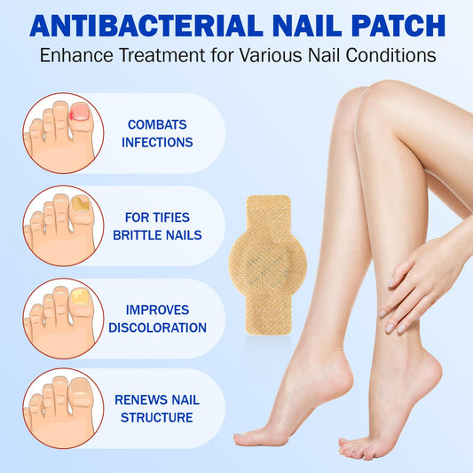 Mcukv Nail Repair Patches individually sealed, mess-free nightly use