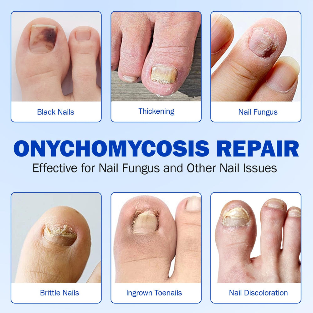 Mcukv Nail Repair Patches travel-friendly design, discreet wear