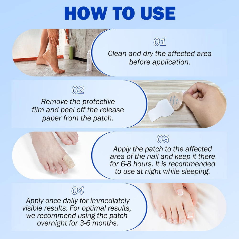 Mcukv Nail Repair Patches after-use close-up, gradual improvement visible