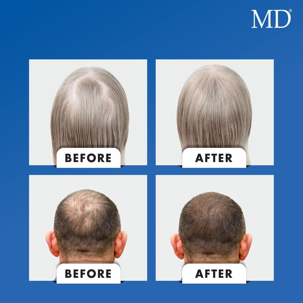 MD Nutri marine collagen peptides support strong elastic hair shafts