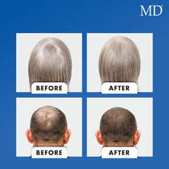 MD Nutri marine collagen peptides support strong elastic hair shafts