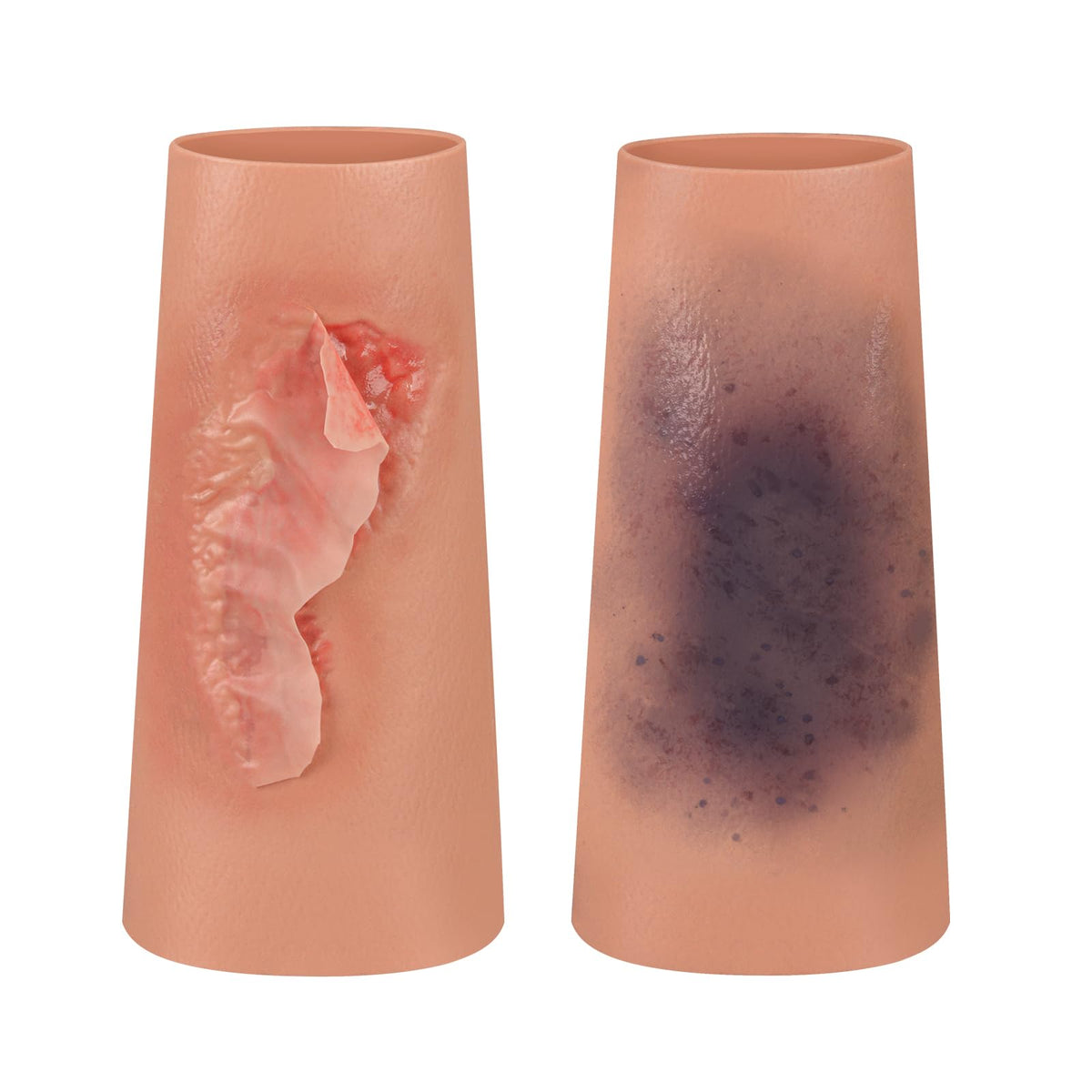 MedEduQuest abrasion wound sleeve offers lifelike texture for realistic wound care practice.