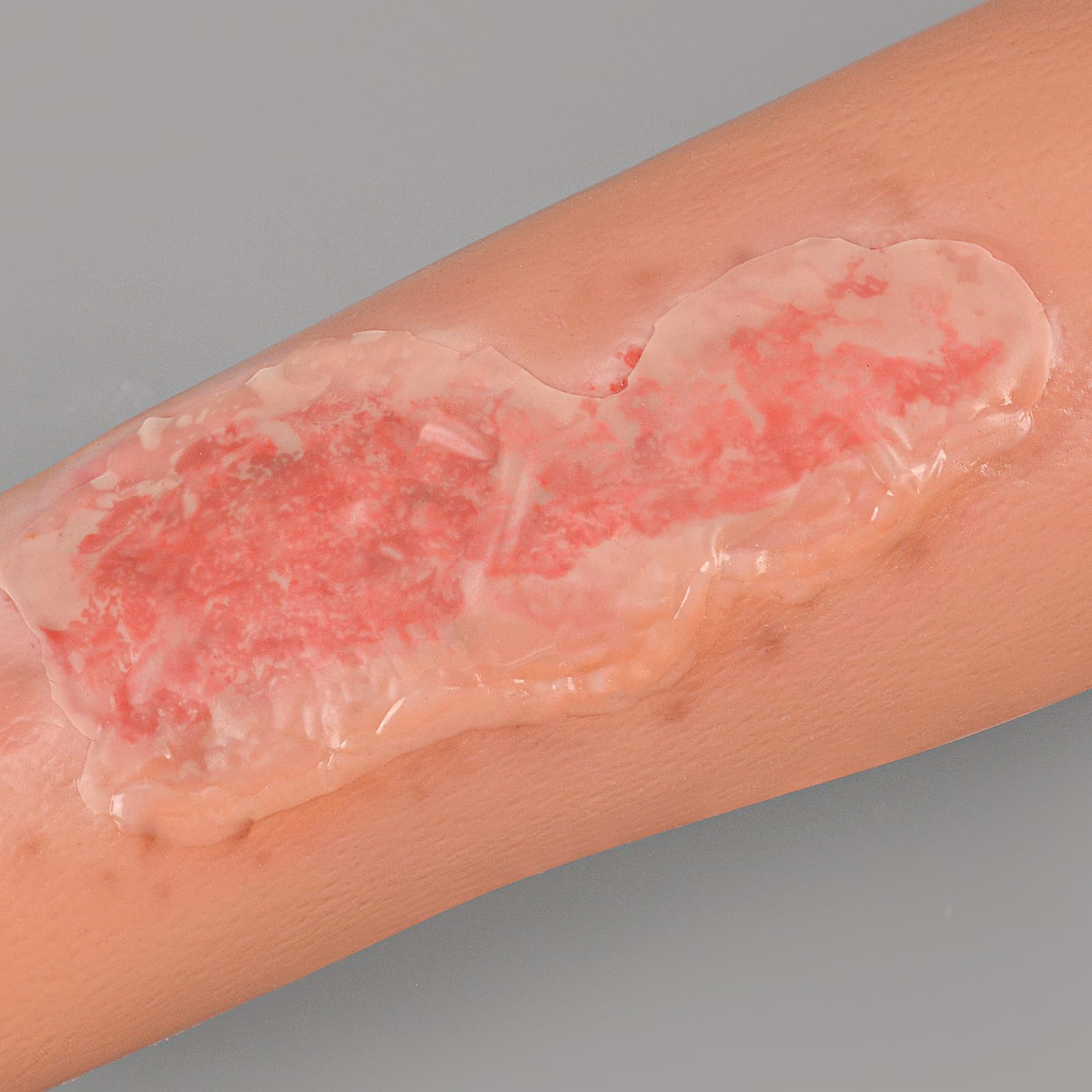 MedEduQuest wound packing trainer enables hands-on learning for proper packing techniques.