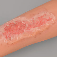 MedEduQuest wound packing trainer enables hands-on learning for proper packing techniques.