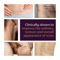 Mederma Advanced Scar Gel tube cap close-up for easy dispensing.