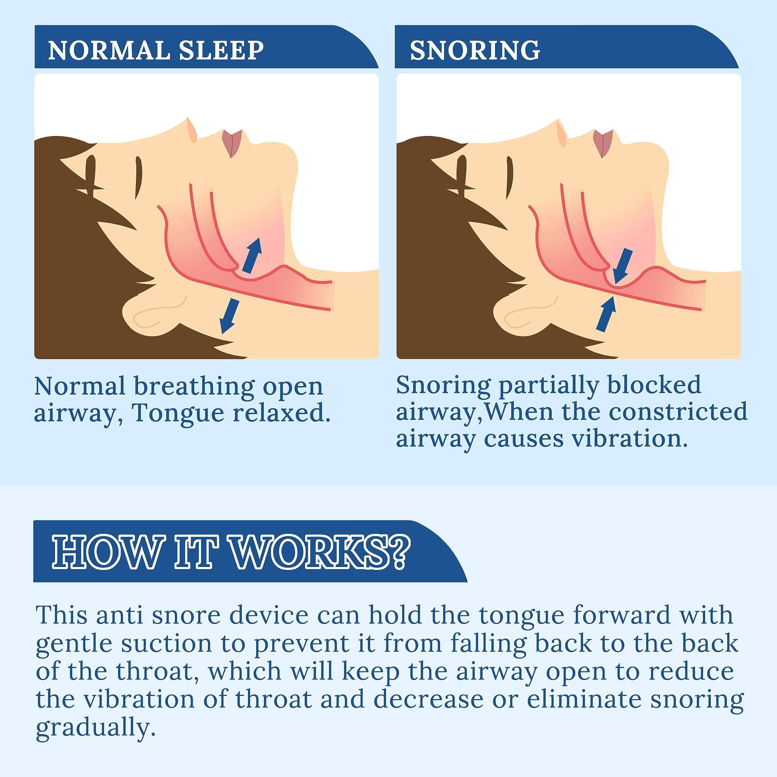 MFANBLAS Snoring Solution easy-use bulb action for quick bedtime setup.