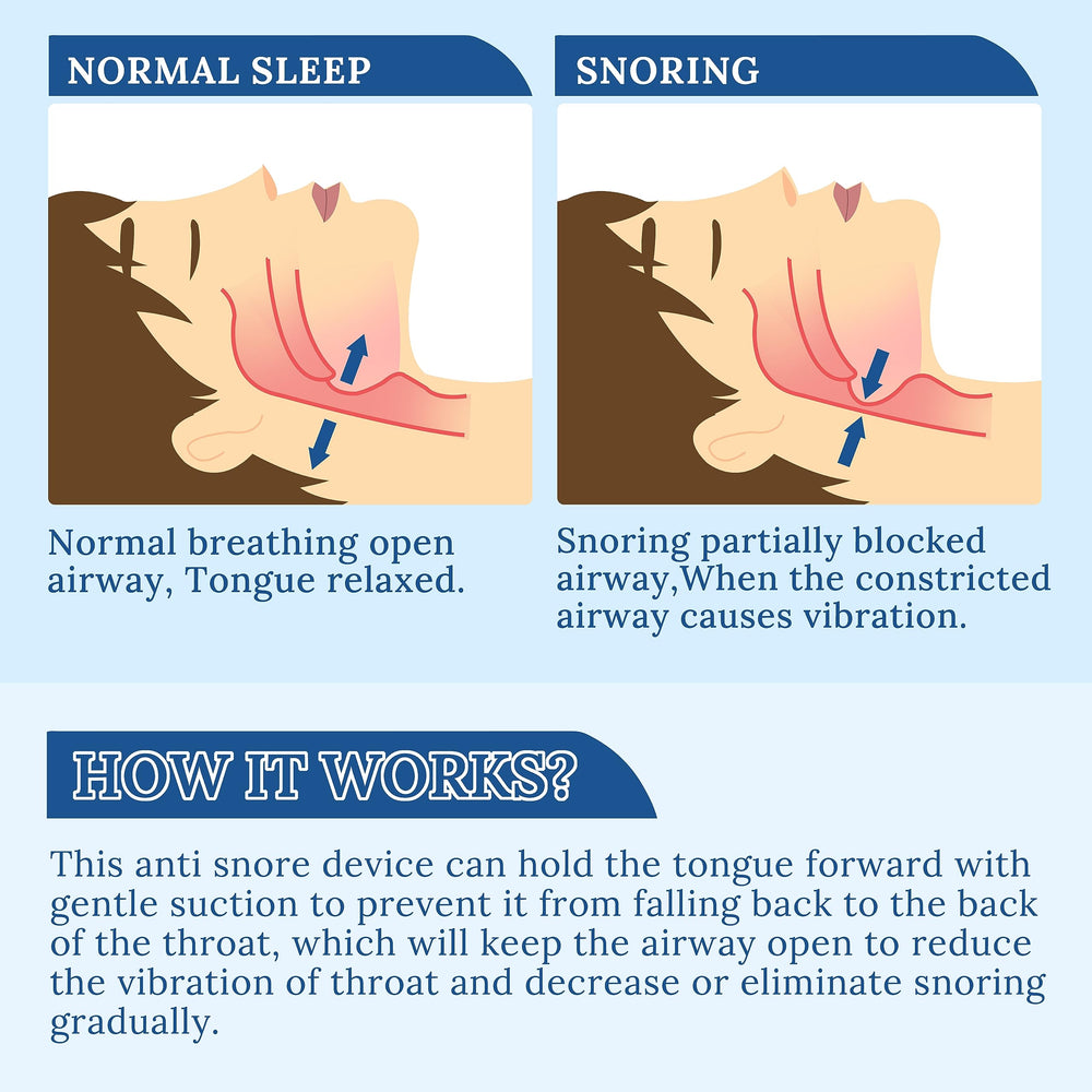 MFANBLAS Snoring Solution easy-use bulb action for quick bedtime setup.