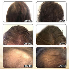 Miracle Elixir Collection lifestyle shot suggesting daily hair care.