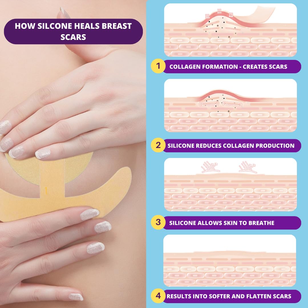Miztag Breast Scar Tape placed on the breast area for discreet coverage.