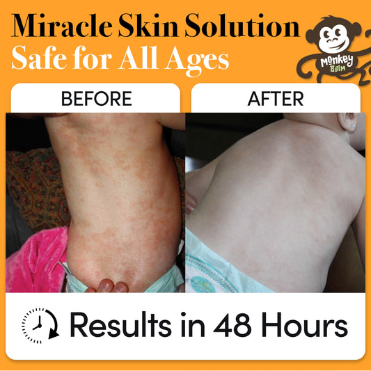 Applying Monkey Balm on hand for easy on-the-go skin comfort.