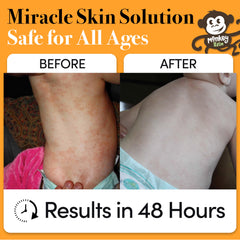 Applying Monkey Balm on hand for easy on-the-go skin comfort.