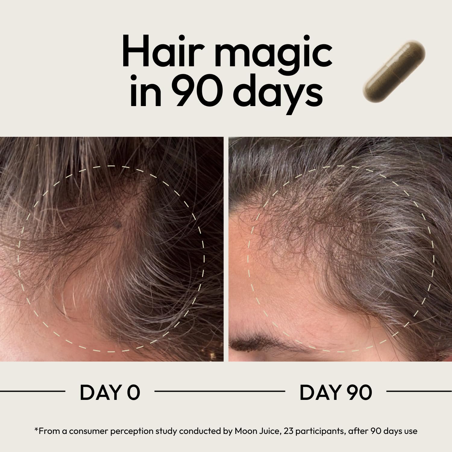 Moon Juice SuperHair pumpkin-seed visual suggests DHT-friendly nourishment for thicker-looking hair.