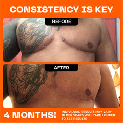 Motivo Scar Tape sweatproof during workout in tan, stays secure with movement.