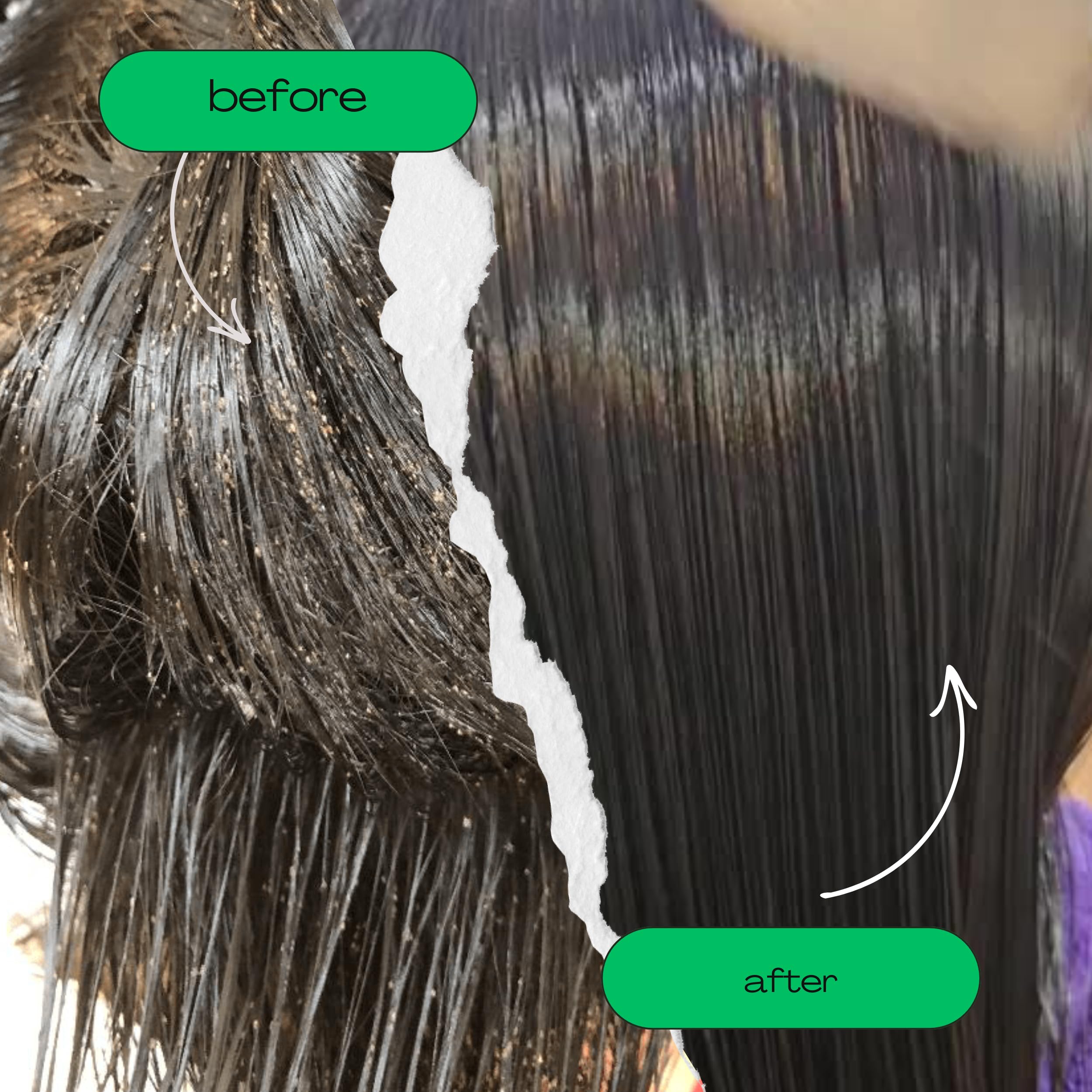 My Hair Helpers nit removal with durable steel teeth.