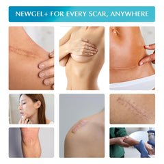 MyNewGel USA-manufactured scar sheets are safe