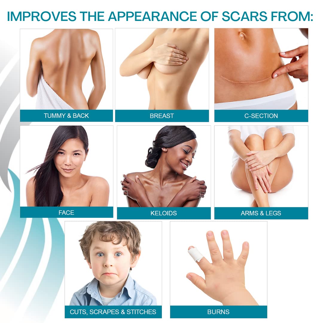 Self-adhesive, reusable sheets can be washed and reused for ongoing scar care routines.