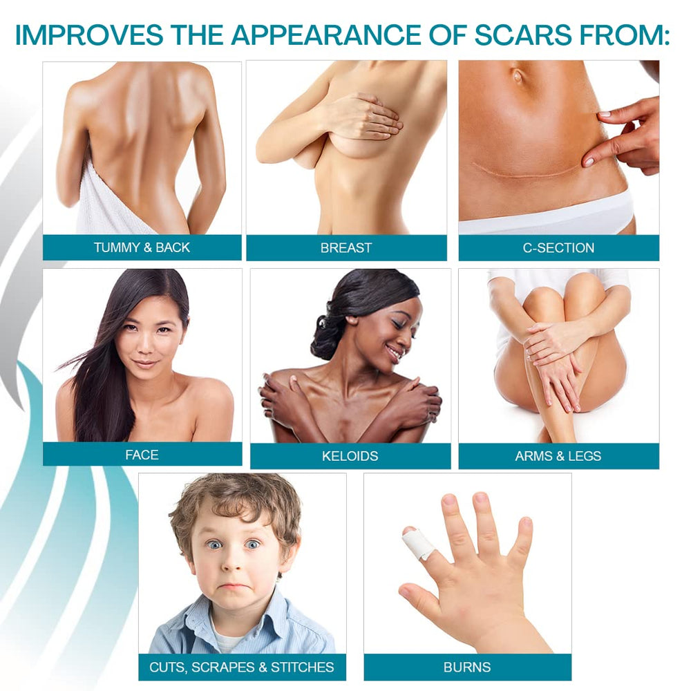 Self-adhesive, reusable sheets can be washed and reused for ongoing scar care routines.