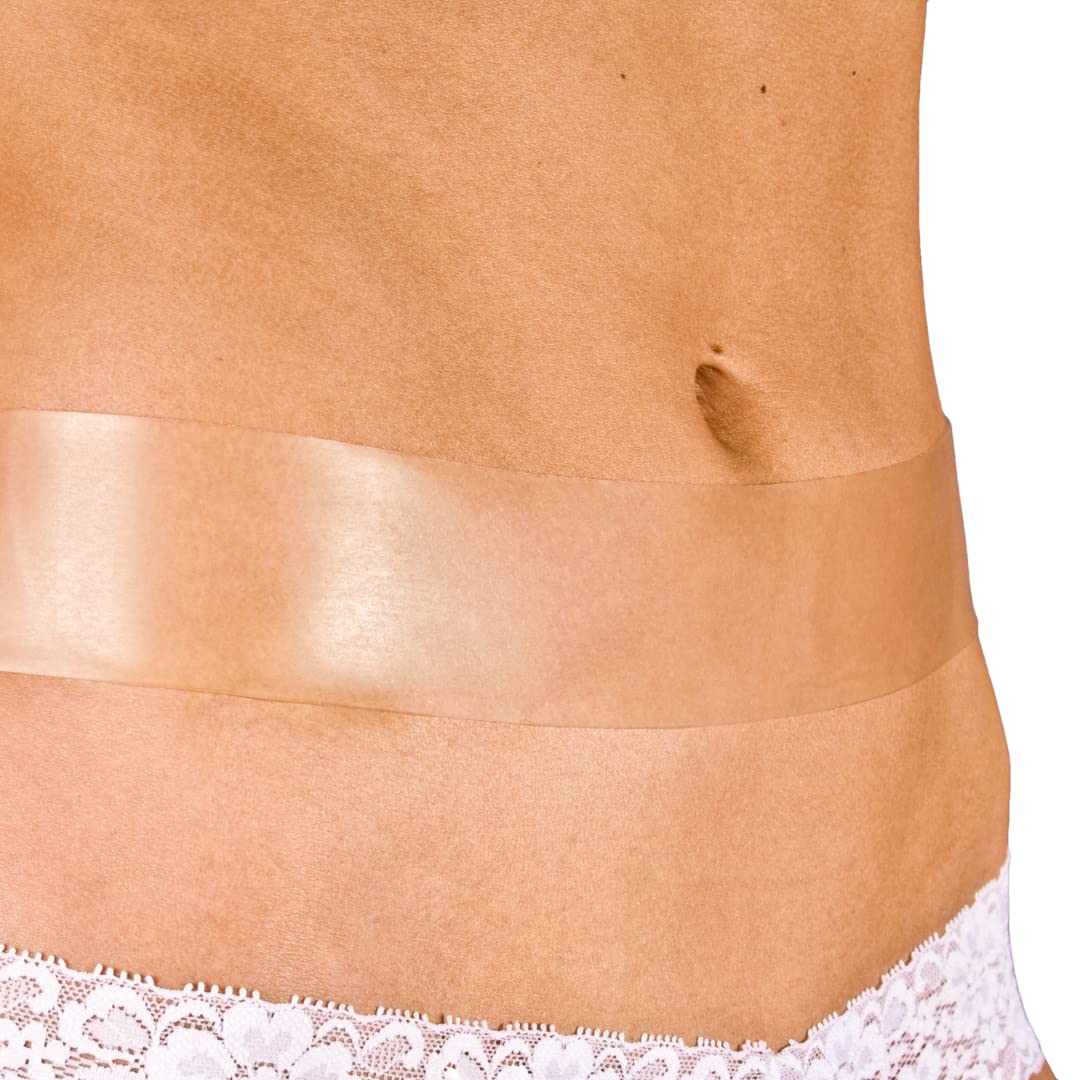 MyNewGel scar tape over a long abdominal scar, providing gentle occlusion and hydration