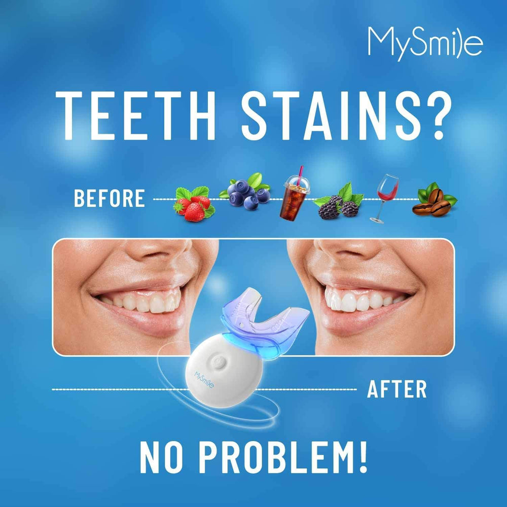 MySmile at-home whitening setup ready for use