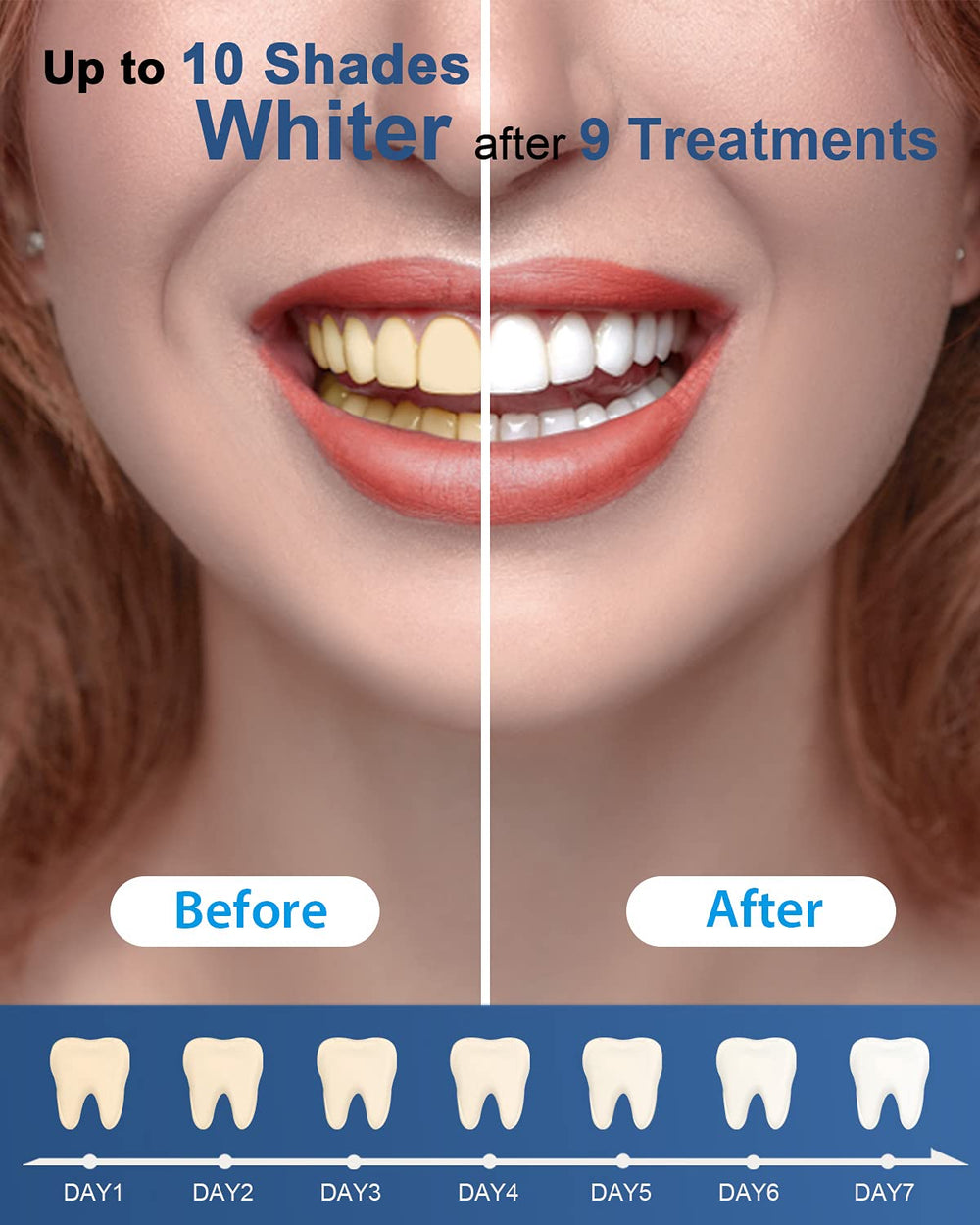 Non-sensitive MySmile formula label indicating gentle whitening.