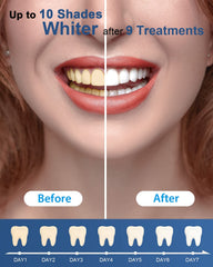 Non-sensitive MySmile formula label indicating gentle whitening.