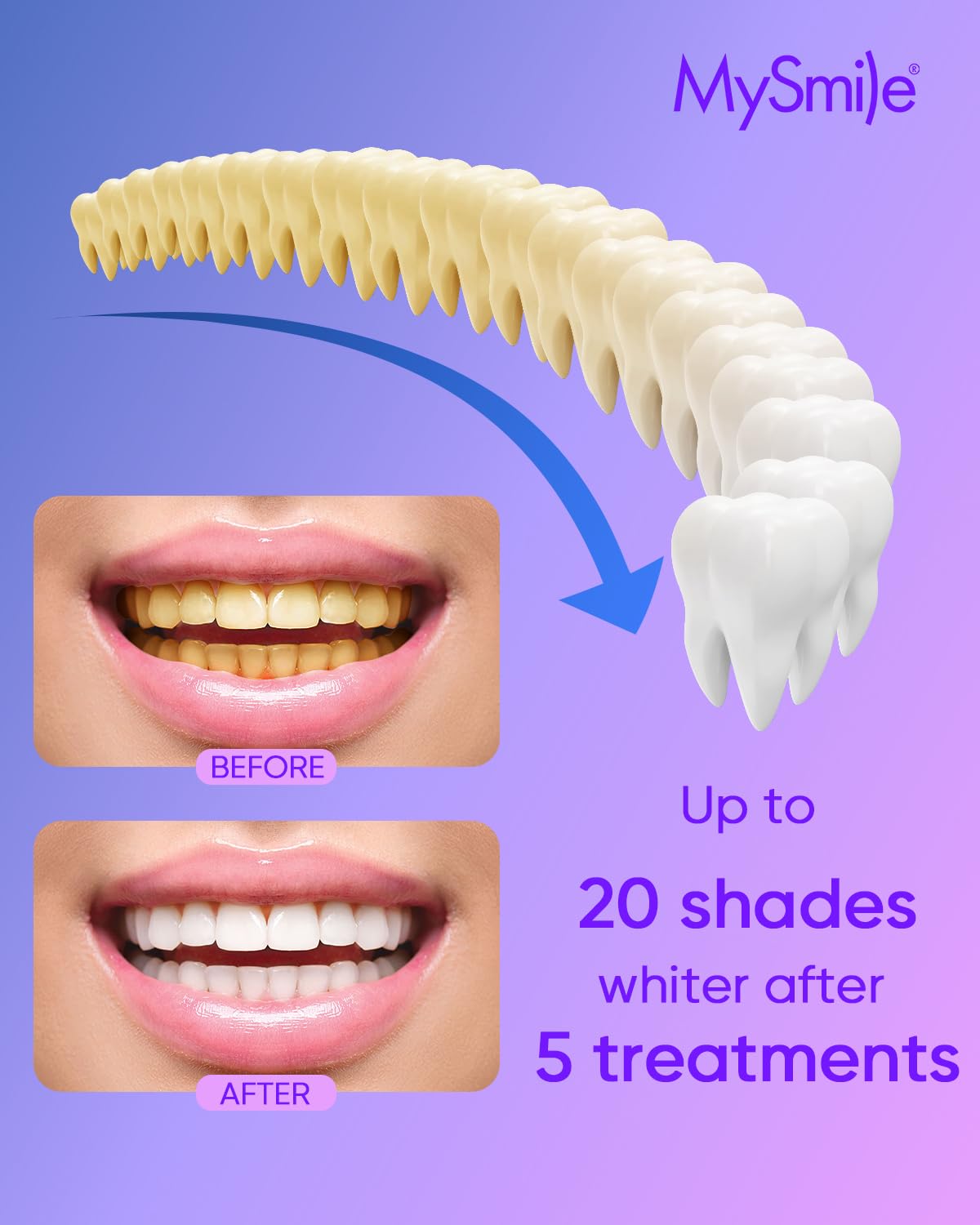 MySmile box label highlights USA-made formula and professional trust