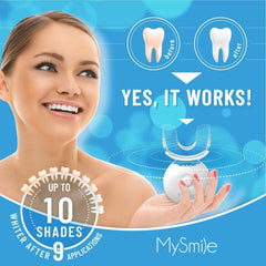 MySmile whitening gel tubes with 35% carbamide peroxide for fast results