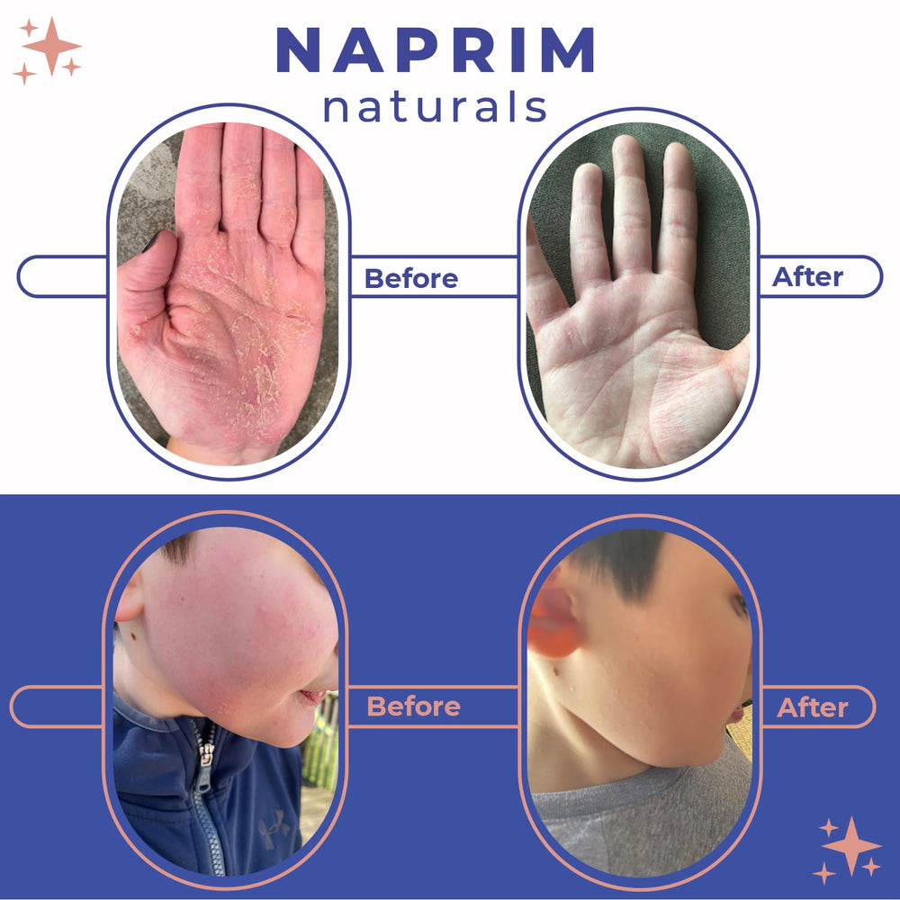 Naprim Naturals Nourishing Powder jar close-up highlighting colloidal oatmeal and gentle ingredients