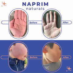 Naprim Naturals Nourishing Powder jar close-up highlighting colloidal oatmeal and gentle ingredients