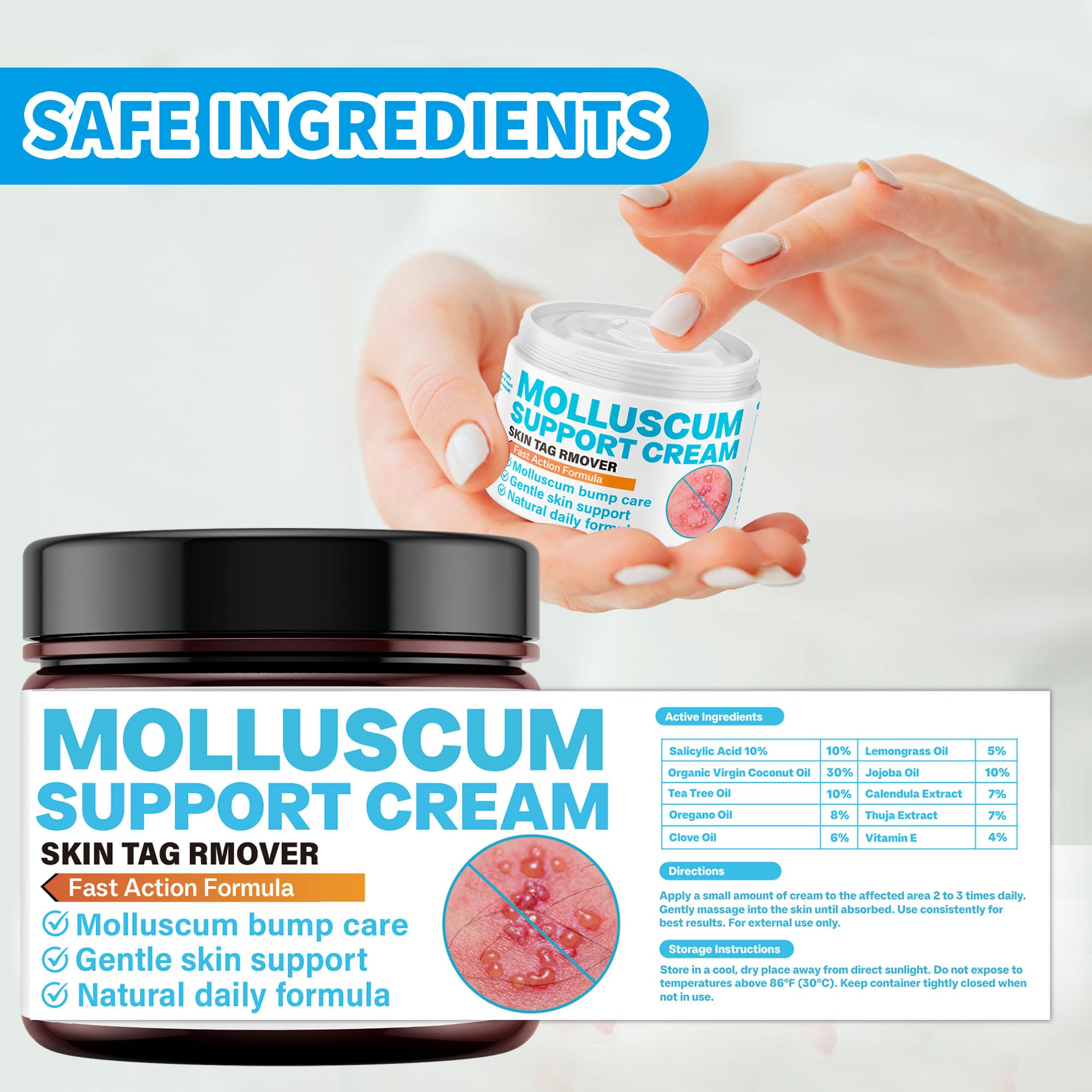 Family-friendly NateNatenight Molluscum Support Cream for home use.