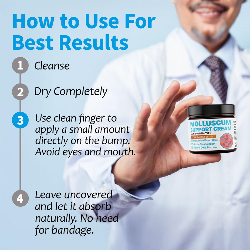 Packaging box of NateNatenight Molluscum Support Cream with usage tips.