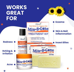 Naturasil Mite-B-Gone cream application on forearm for quick relief.